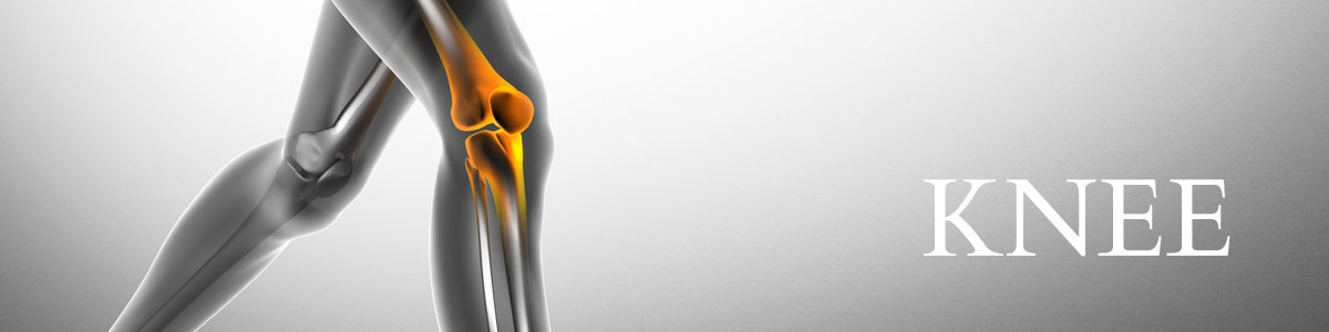 Periarticular Osteotomy for Knee Osteoarthritis
